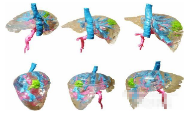 波蘭創(chuàng)建低成本彩色肝臟<a href=http://m.ttyulecheng168.com/dayin.html target=_blank class=infotextkey>3D打印模型</a>